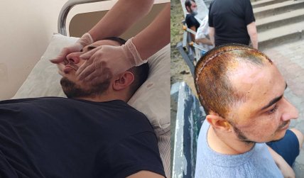 в лікарні після поранення